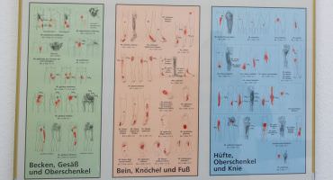 Spezielle orthopädische Chirurgie Bonn