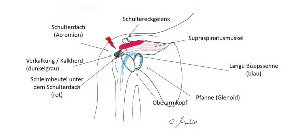 Die Schulter ist ein Spezialgebiet von Orthopäde und Chirurg Wingenfeld in Bonn